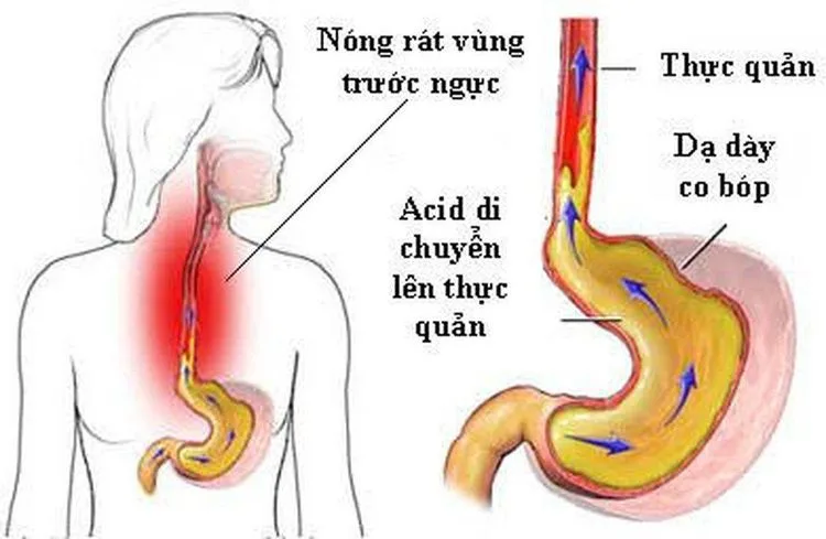 7-dau-hieu-trao-nguoc-da-day-ban-nen-biet-mnba